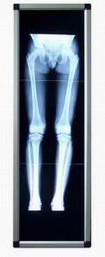 ����ʽ��Ƭ��