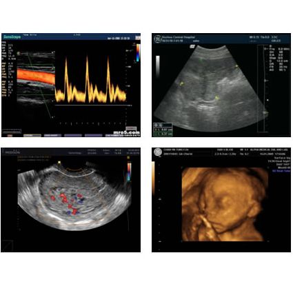 ҽ����īB����Ƭ