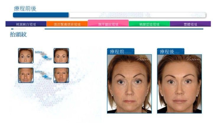 ͸������