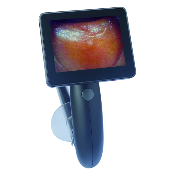 �ֳ�ʽ��Ƶ�س��ڿ���/�س���/ֱ����