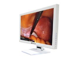 21.5Ӣ���ڿ�����ҽ����ʾ��ҽ��Һ����ʾ��