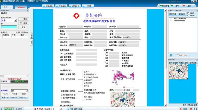 Һ��ϸ��ͼ�ı���ϵͳ/Һ��ϸ��ͼ������