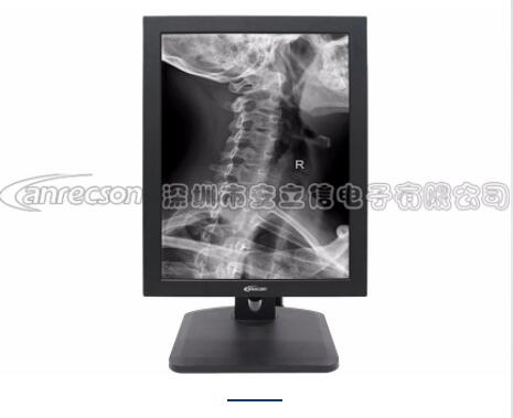 ������19Ӣ��1M�ҽ�ҽ����ʾ�� ���������ʾ��