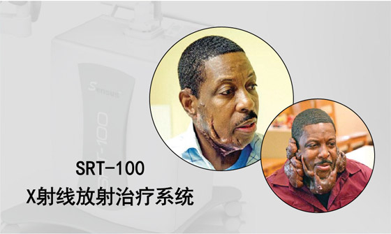 X���߷�������ϵͳ