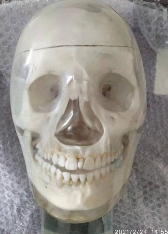 ���˹�ͷ����X����ͷ��ģ��