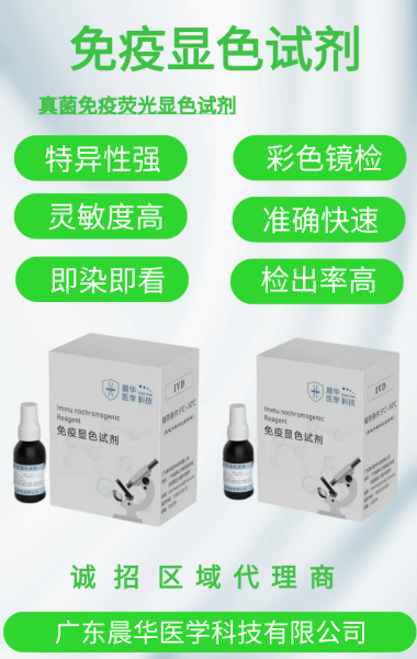 �㶫����Ƥ�������ӫ��������ɫ�Լ�/ȾɫҺ