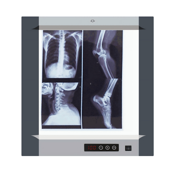 ���¶�LED��Ƭ�ƹǿ���Ƭ�����ƿ�Ƭ��x��ɴ������������ѡ