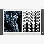 ˫����Ƭ��