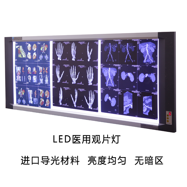 ����LEDҽ�ù�Ƭ��  ����ֱ��  ���ݰ�ͼҽ��