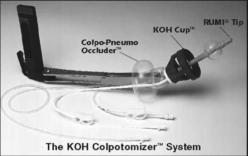 ����Coopersurgical�ٹ���