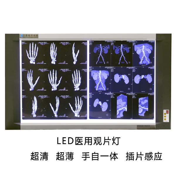 ˫��LEDҽ�ù�Ƭ��  ����ֱ��  ���ݰ�ͼҽ��