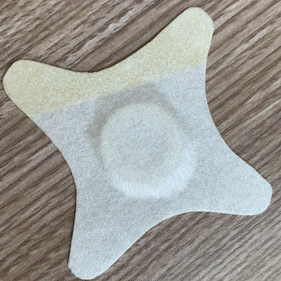 ��˿������ Ӥ�׶��ò�˿��Ѩλ��