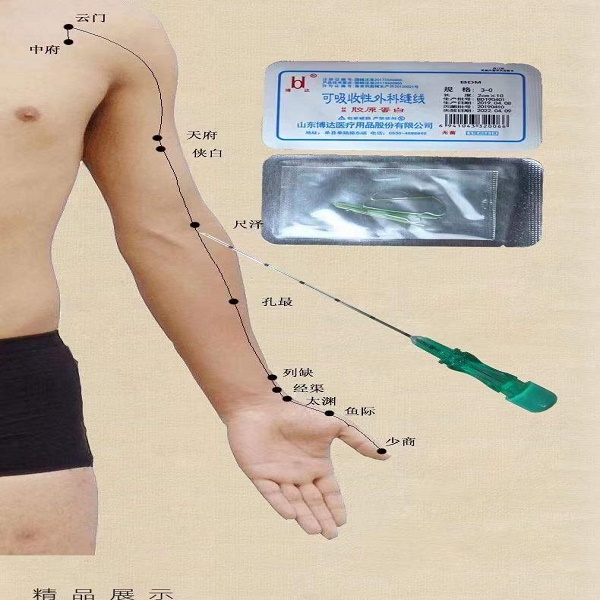 Ѩλ����/Ѩλ�����/ҽ������/��ԭ������/������/�Ͼ���