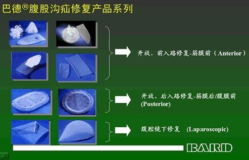 �͵�BARD���޲�Ƭ����