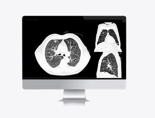 i-3D�ν�ڷ���ģ��