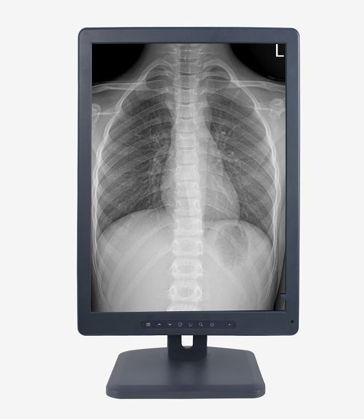 2M�ҽ�ҽ����ʾ��