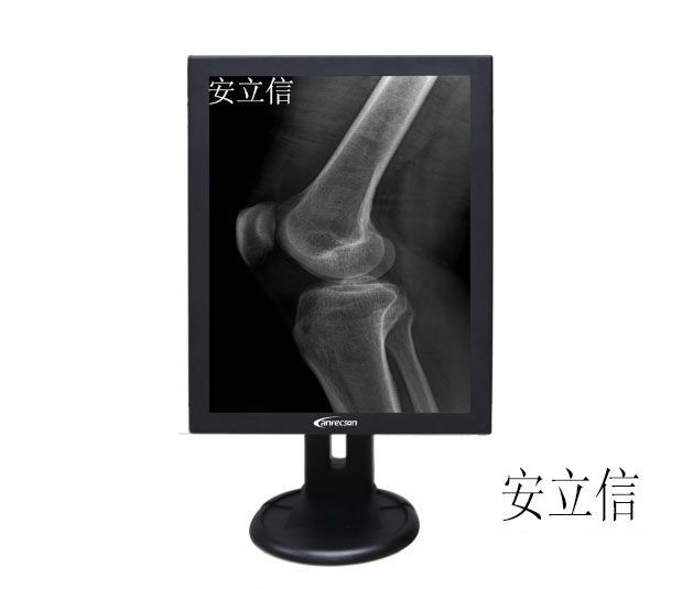 DR/CT/MRI�˴Ź����ҽ���豸�õ�2M����ҽ����ʾ��