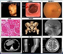 ȫ�ܴ�ҽ�ý�Ƭ