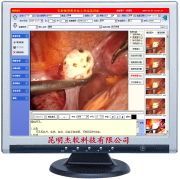 ��ǻ��Ӱ��ϵͳ����վ