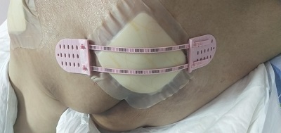 Ƥ��ǣ���պ���