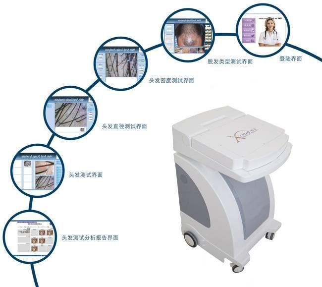 ����ë���������ܷ���ϵͳ