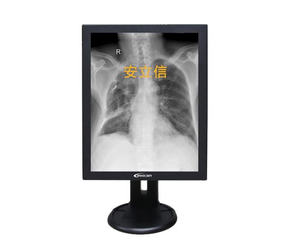 CT�豸/����CT/����CT��ҽ����ʾ��