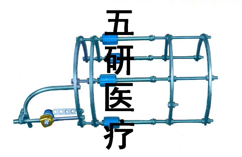 ��������뻷�͹ɹ��ӳ���̶���