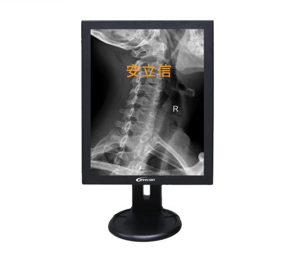 ������LC-MS21302�ҽ�2MP��ʾ��