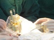 ���嶨������ϵͳ