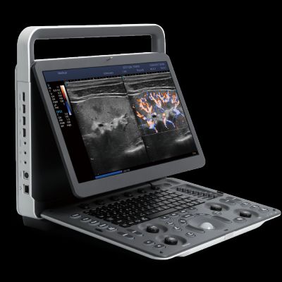 ����E1EXP ��Яʽ�ʳ�