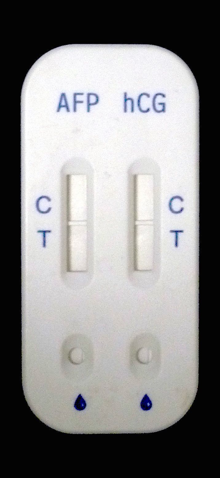 �����ۺ�֢����Լ��У�����𷨣�