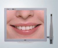 ��ǻ�ڿ���