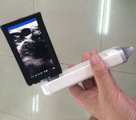 XProbeϵ�д�������̽ͷʽB�����ϳ������㳬��