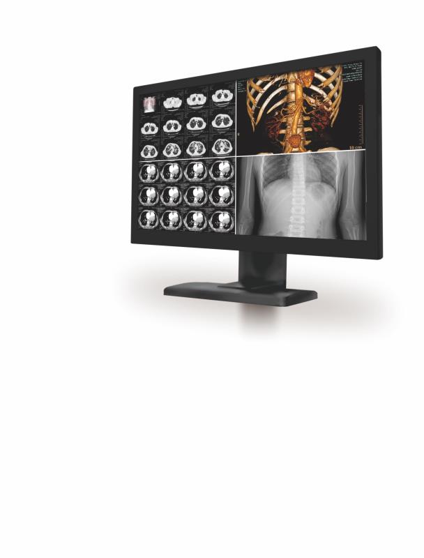 4Mһ�廯˫��ҽ����ʾ��