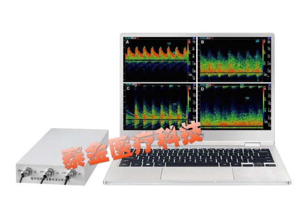 ��­������Ѫ��������( ��Яʽ)��TCD���Բʳ�