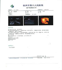 JZ����ҽ�ý�Ƭ