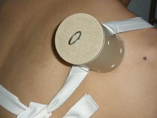 ��ҽ���������Ĺ���ʹ