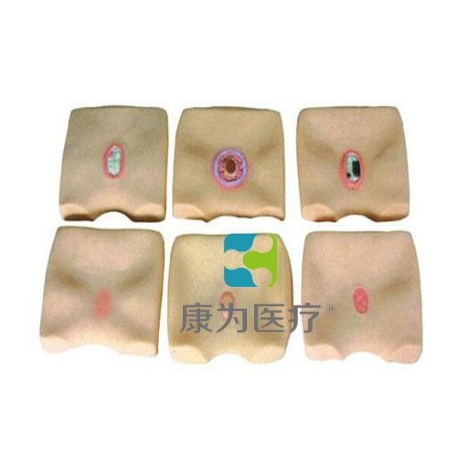 �����촯����ģ��