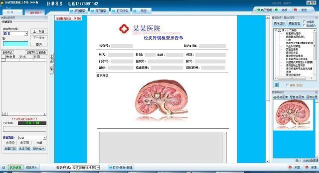 ��Ƥ����ͼ�ı������ϵͳ����