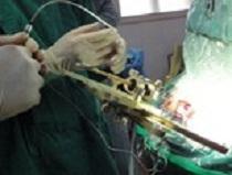 ���嶨������ϵͳ