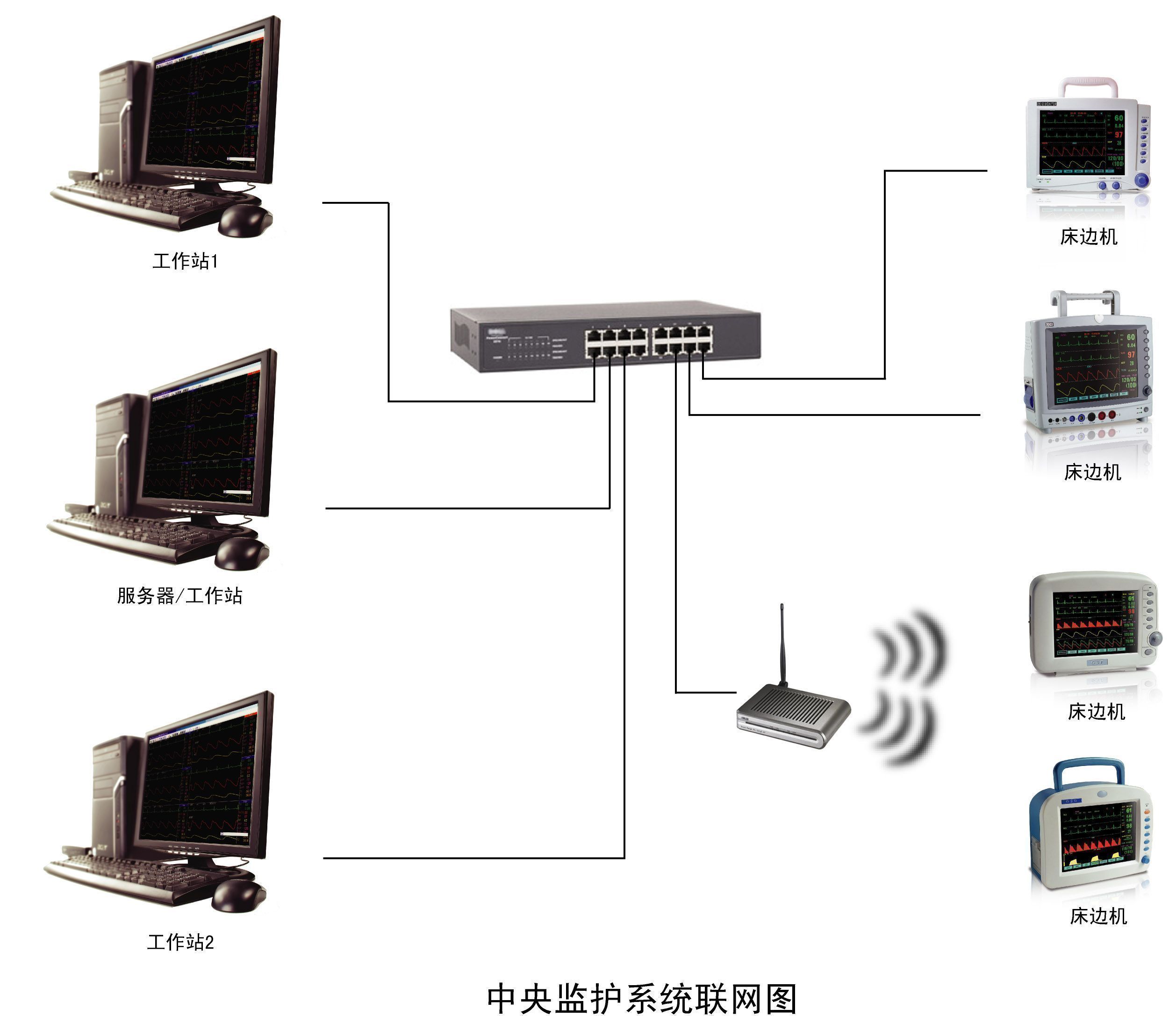 ������2800����໤ϵͳ