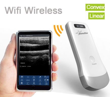 UProbeϵ��͹��/����̽ͷʽ����B�����߳������ϳ���