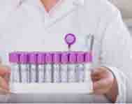 ��Ѫ�ܷ������