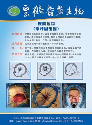 Ƥ��������ǣ���̶�����