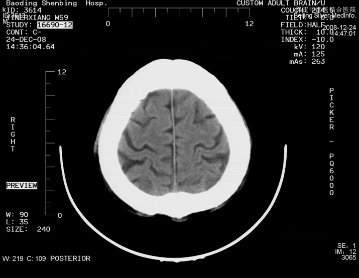 �����ҽ�ü��⽺Ƭ