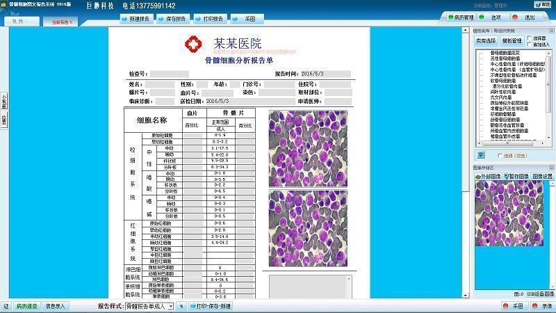 ����ϸ��ͼ�ı���ϵͳ����