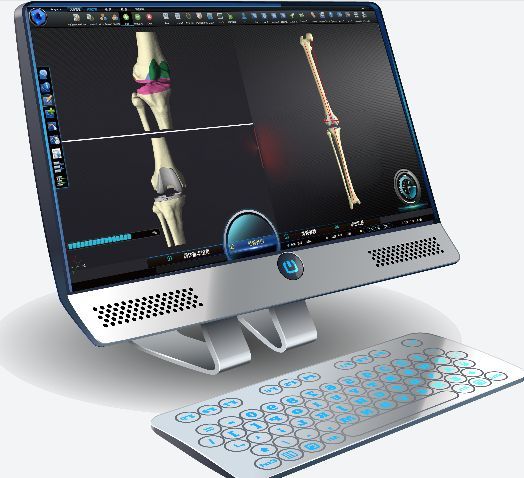 ҽѧ3D�����滮����ϵͳArigin 3DPro