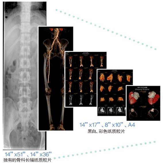 ҽ��ֽ�ʽ�Ƭ