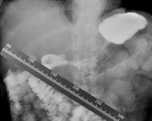 ��Ӱ����,��͸���߱�ǳ�