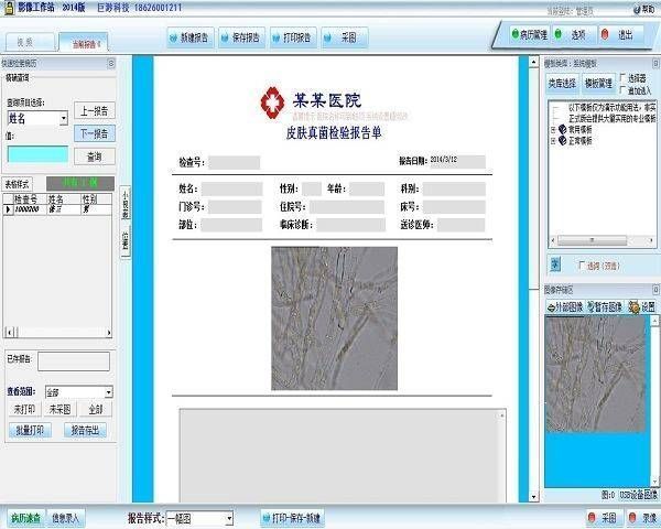 Ƥ��������ϵͳ